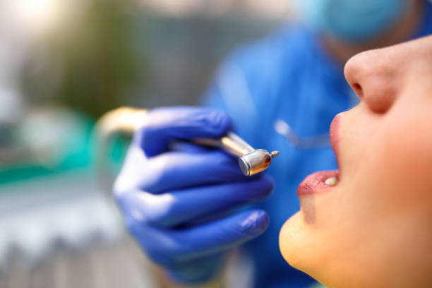 Dental Bonding in Greer, SC